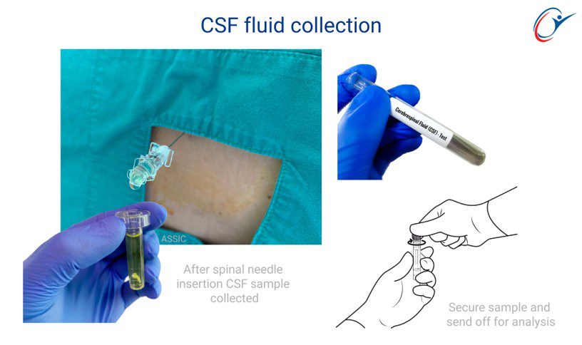 Emergency Care Seizures Practical - Lumbar Puncture | ASSIC Education