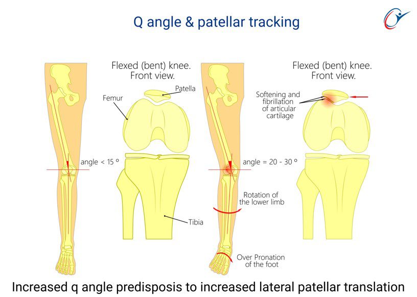 Rugby Sport Science Injuries - Lower Limb - Knee & Lower Leg - Rugby ...