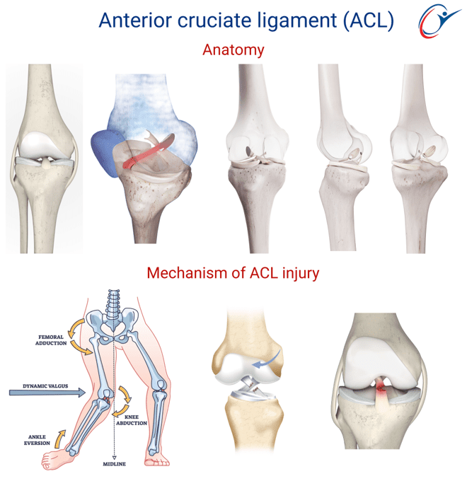 Knee - ACL Tear | ASSIC Education
