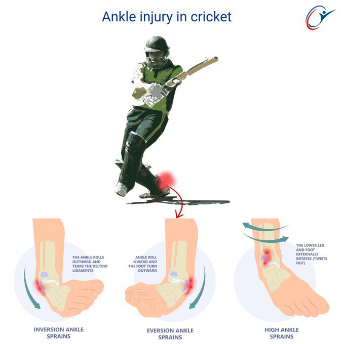 Volleyball Sport Science Injuries - Lower Limb - Ankle & Foot - Ankle ...