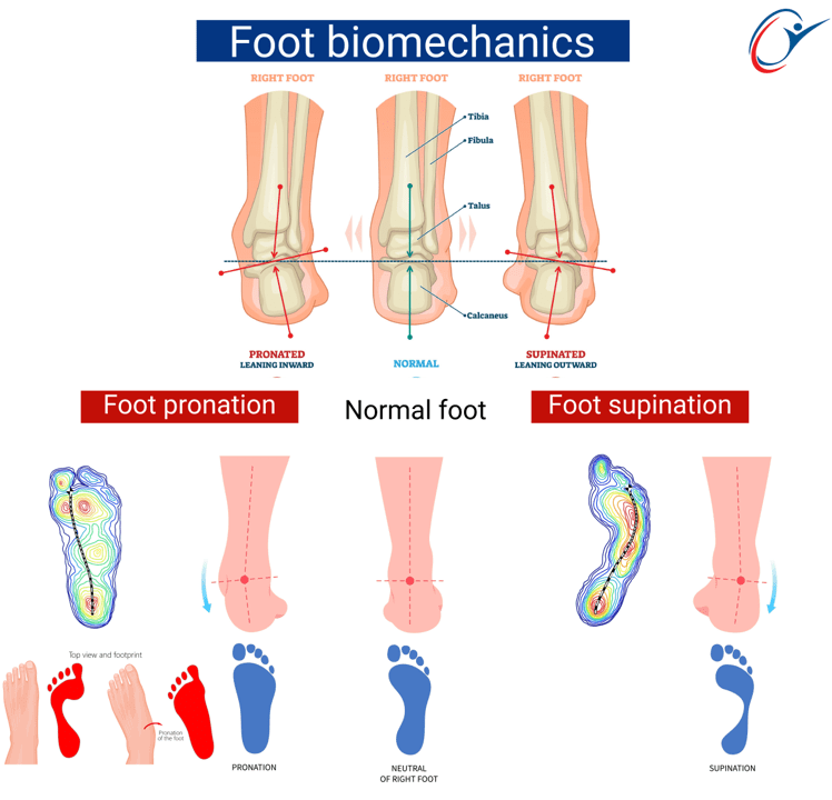 External Rotation Of Foot Lower Leg - Medial Tibia Stress Syndrome | ASSIC Education