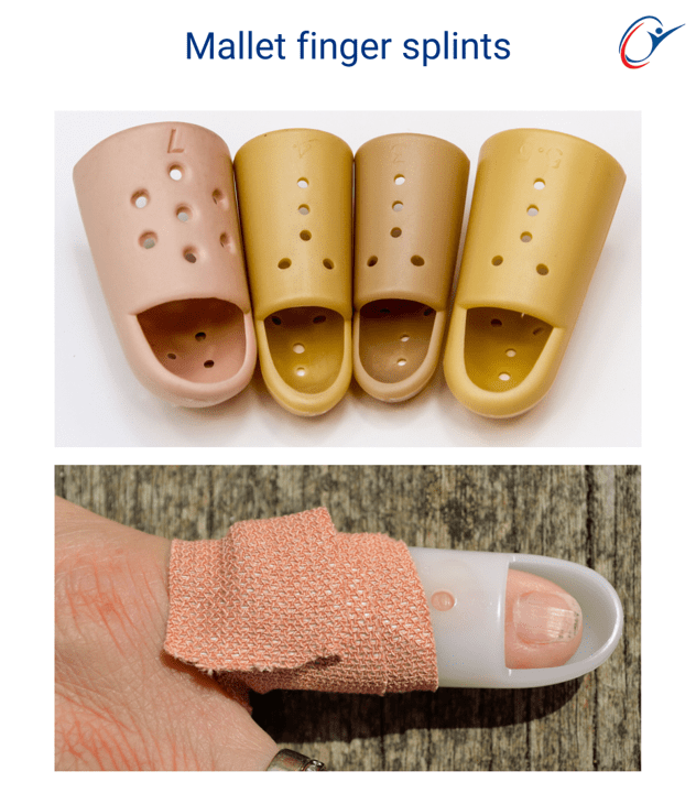 Netball Finger Injry Netball Injuries Part 1 | ASSIC Education