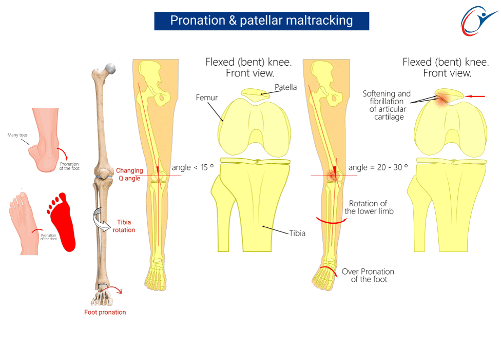 Gait Cycle | ASSIC Education