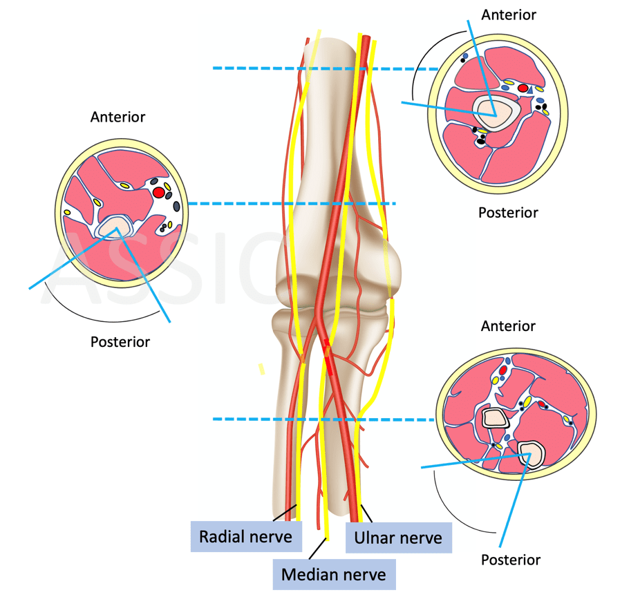Elbow - Elbow Dislocation | ASSIC Education
