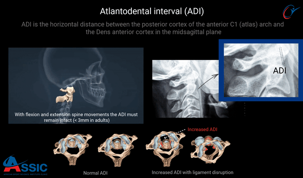 C-Spine Flexion/Extension X-Rays | ASSIC Education