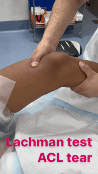 Knee - ACL Tear | ASSIC Education