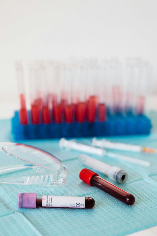 blood testing protein