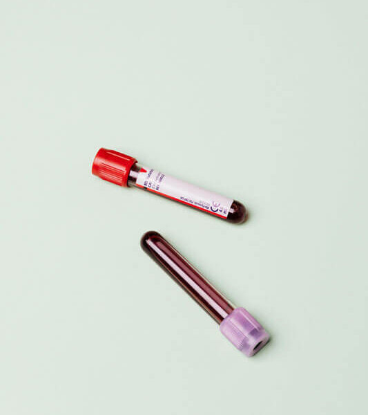 blood count